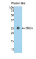 Western Blot; Sample: Recombinant protein.