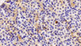 DAB staining on IHC-P; Samples: Rat Stomach Tissue; Primary Ab: 10μg/ml Rabbit Anti-Rat CCDC80 Antibody Second Ab: 2µg/mL HRP-Linked Caprine Anti-Rabbit IgG Polyclonal Antibody
