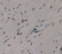 Af4/Fmr2 Family, Member 1 (Aff1) Polyclonal Antibody, Cat#CAU21631