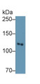 Western Blot; Sample: Porcine Liver lysate; Primary Ab: 0.1μg/ml Rabbit Anti-Human PIK3Cb Antibody; Second Ab: 0.2µg/mL HRP-Linked Caprine Anti-Rabbit IgG Polyclonal Antibody;