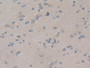 DAB staining on IHC-P; Samples: Human Cerebrum Tissue; Primary Ab: 10µg/ml Rabbit Anti-Human PIK3C3 Antibody Second Ab: 2µg/mL HRP-Linked Caprine Anti-Rabbit IgG Polyclonal Antibody