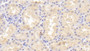 DAB staining on IHC-P; Samples: Human Kidney Tissue;  Primary Ab: 20μg/ml Rabbit Anti-Human TANK Antibody Second Ab: 2µg/mL HRP-Linked Caprine Anti-Rabbit IgG Polyclonal Antibody 