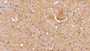 Non Metastatic Cells 2, Protein Nm23B Expressed In (Nme2) Polyclonal Antibody, Cat#CAU21648