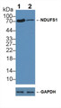 Knockout Varification: &lt;br/&gt;Lane 1: Wild-type A549 cell lysate; &lt;br/&gt;Lane 2: NDUFS1 knockout A549 cell lysate; &lt;br/&gt;Predicted MW: 81,79,74,68kd &lt;br/&gt;Observed MW: 74kd&lt;br/&gt;Primary Ab: 2µg/ml Rabbit Anti-Human NDUFS1 Antibody&lt;br/&gt;Second Ab: 0.2µg/mL HRP-Linked Caprine Anti-Rabbit IgG Polyclonal Antibody&lt;br/&gt;