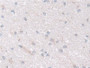 DAB staining on IHC-P; Samples: Human Cerebrum Tissue; Primary Ab: 30µg/ml Rabbit Anti-Human NDUFS1 Antibody Second Ab: 2µg/mL HRP-Linked Caprine Anti-Rabbit IgG Polyclonal Antibody