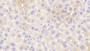 DAB staining on fromalin fixed paraffin- embedded brain tissue)