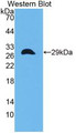 Western Blot; Sample: Recombinant protein.