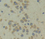 Used in DAB staining on fromalin fixed paraffin- embedded Kidney tissue