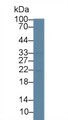 Western Blot; Sample: Rat Cerebrum lysate; Primary Ab: 1µg/ml Rabbit Anti-Rat vHL Antibody Second Ab: 0.2µg/mL HRP-Linked Caprine Anti-Rabbit IgG Polyclonal Antibody