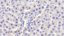 DAB staining on IHC-P; Samples: Rat Liver Tissue; Primary Ab: 20μg/ml Rabbit Anti-Rat vHL Antibody Second Ab: 2µg/mL HRP-Linked Caprine Anti-Rabbit IgG Polyclonal Antibody