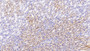 DAB staining on IHC-P; Samples: Mouse Kidney Tissue; Primary Ab: 20μg/ml Rabbit Anti-Mouse SDHB Antibody Second Ab: 2µg/mL HRP-Linked Caprine Anti-Rabbit IgG Polyclonal Antibody