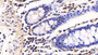 DAB staining on IHC-P; Sample: Human Colon Tissue; Primary Ab: 20ug/ml Rabbit Anti-Human IL21R Antibody Second Ab: 2µg/mL HRP-Linked Caprine Anti-Rabbit IgG Polyclonal Antibody