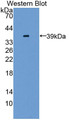 Western Blot; Sample: Recombinant GLI3, Mouse.