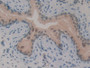 DAB staining on IHC-P; Samples: Mouse Vas Deferens Tissue; Primary Ab: 10µg/ml Rabbit Anti-Mouse GLI3 Antibody Second Ab: 2µg/mL HRP-Linked Caprine Anti-Rabbit IgG Polyclonal Antibody