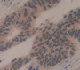 Gli Family Zinc Finger Protein 3 (Gli3) Polyclonal Antibody, Cat#CAU21666