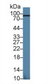 Western Blot; Sample: Mouse Kidney lysate; Primary Ab: 1.5µg/ml Rabbit Anti-Mouse ACO1 Antibody Second Ab: 0.2µg/mL HRP-Linked Caprine Anti-Rabbit IgG Polyclonal Antibody