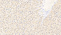 DAB staining on IHC-P; Samples: Human Liver Tissue; Primary Ab: 20μg/ml Rabbit Anti-Human ACO1 Antibody Second Ab: 2µg/mL HRP-Linked Caprine Anti-Rabbit IgG Polyclonal Antibody