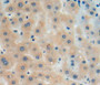 DAB staining on fromalin fixed paraffin-embedded liver tissue)