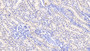 DAB staining on IHC-P; Samples: Human Kidney Tissue; Primary Ab: 20μg/ml Rabbit Anti-Human AGMAT Antibody Second Ab: 2µg/mL HRP-Linked Caprine Anti-Rabbit IgG Polyclonal Antibody