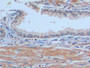 DAB staining on IHC-P; Samples: Human Prostate Tissue;  Primary Ab: 10µg/ml Rabbit Anti-Human aMACR 