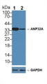 Knockout Varification: &lt;br/&gt;Lane 1: Wild-type Hela cell lysate; &lt;br/&gt;Lane 2: ANP32A knockout Hela cell lysate; &lt;br/&gt;Predicted MW: 29kd &lt;br/&gt;Observed MW: 35kd&lt;br/&gt;Primary Ab: 1µg/ml Rabbit Anti-Human ANP32A Antibody&lt;br/&gt;Second Ab: 0.2µg/mL HRP-Linked Caprine Anti-Rabbit IgG Polyclonal Antibody&lt;br/&gt;