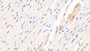 DAB staining on IHC-P; Samples: Human Cardiac Muscle Tissue;  Primary Ab: 20μg/ml Rabbit Anti-Human TSPO Antibody Second Ab: 2µg/mL HRP-Linked Caprine Anti-Rabbit IgG Polyclonal Antibody 