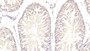 DAB staining on IHC-P; Samples: Rat Testis Tissue;  Primary Ab: 20μg/ml Rabbit Anti-Rat ARPC4 Antibody Second Ab: 2µg/mL HRP-Linked Caprine Anti-Rabbit IgG Polyclonal Antibody 