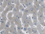 DAB staining on IHC-P; Samples: Human Liver Tissue;  Primary Ab: 20µg/ml Rabbit Anti-Human ARPC4 Ant