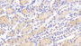 DAB staining on fromalin fixed paraffin-embedded Liver tissue)