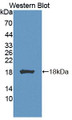 Western Blot; Sample: Recombinant protein.