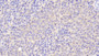 DAB staining on IHC-P; Samples: Human Spleen Tissue; Primary Ab: 20μg/ml Rabbit Anti-Human BLVRA Antibody Second Ab: 2µg/mL HRP-Linked Caprine Anti-Rabbit IgG Polyclonal Antibody