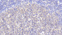 DAB staining on fromalin fixed paraffin- embedded liver tissue)