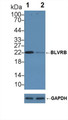 Knockout Varification: &lt;br/&gt;Lane 1: Wild-type Hela cell lysate; &lt;br/&gt;Lane 2: BLVRB knockout Hela cell lysate; &lt;br/&gt;Predicted MW: 22kd &lt;br/&gt;Observed MW: 22kd&lt;br/&gt;Primary Ab: 1µg/ml Rabbit Anti-Human BLVRB Antibody&lt;br/&gt;Second Ab: 0.2µg/mL HRP-Linked Caprine Anti-Rabbit IgG Polyclonal Antibody&lt;br/&gt;