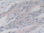 DABstainingonIHC-P.Samples:HumanTissue)