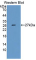 Western Blot; Sample: Recombinant protein.