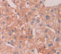 Chitinase 1 (Chit1) Polyclonal Antibody, Cat#CAU21727