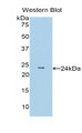 Western Blot; Sample: Recombinant protein.