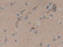 DAB staining on IHC-P; Samples: Human Brain Tissue; Primary Ab: 5µg/ml Rabbit Anti-Human CORO1A Antibody Second Ab: 2µg/mL HRP-Linked Caprine Anti-Rabbit IgG Polyclonal Antibody