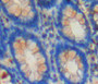 DAB staining on fromalin fixed paraffin-embedded rectum tissue)
