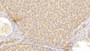 DAB staining on IHC-P; Samples: Human Liver Tissue; Primary Ab: 20μg/ml Rabbit Anti-Human CSN3 Antibody Second Ab: 2µg/mL HRP-Linked Caprine Anti-Rabbit IgG Polyclonal Antibody