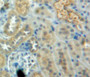 DAB staining on fromalin fixed paraffin-embedded kidney tissue)