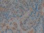 DAB staining on IHC-P; Samples: Human Thyroid Tissue;  Primary Ab: 20µg/ml Rabbit Anti-Human CSTB An