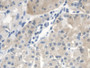 DAB staining on IHC-P; Samples: Human Stomach Tissue; Primary Ab: 20µg/ml Rabbit Anti-Human CTBS Antibody Second Ab: 2µg/mL HRP-Linked Caprine Anti-Rabbit IgG Polyclonal Antibody