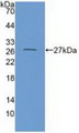 Western Blot; Sample: Recombinant CXADR, Human.