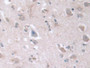 DAB staining on IHC-P; Samples: Human Cerebrum Tissue; Primary Ab: 10µg/ml Rabbit Anti-Human D2HGDH Antibody Second Ab: 2µg/mL HRP-Linked Caprine Anti-Rabbit IgG Polyclonal Antibody