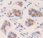 Debranching Enzyme Homolog 1 (Dbr1) Polyclonal Antibody, Cat#CAU21755