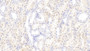 DAB staining on fromalin fixed paraffin- embedded Kidney tissue)