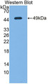 Western Blot; Sample: Recombinant protein.