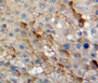 Used in DAB staining on fromalin fixed paraffin-embedded liver tissue