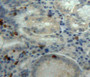 DAB staining on fromalin fixed paraffin-embedded stomach tissue)